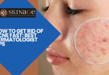 How to Get Rid of Acne Fast: Best Dermatologist Tips