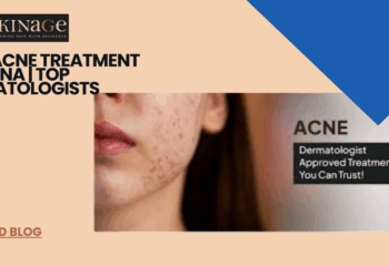 Best Acne Treatment in Patna | Top Dermatologists