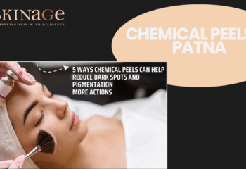Chemical Peels in Patna: Types & Results