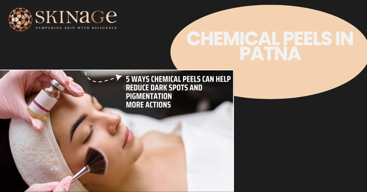 Chemical Peels in Patna: Types & Results